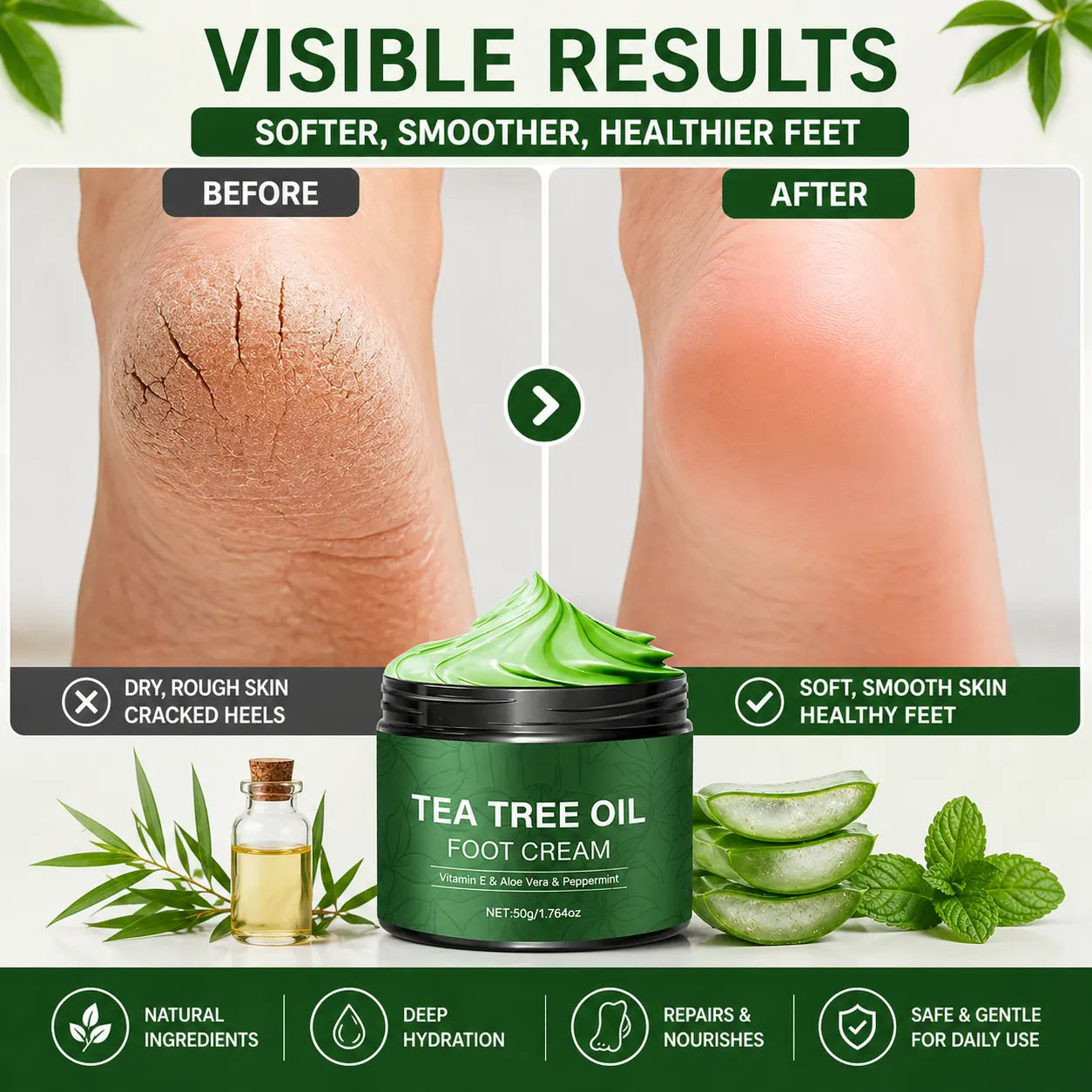 BUY 1 GET 1 FREE Cracked Heel Cream – Aloe Vera & Tea Tree