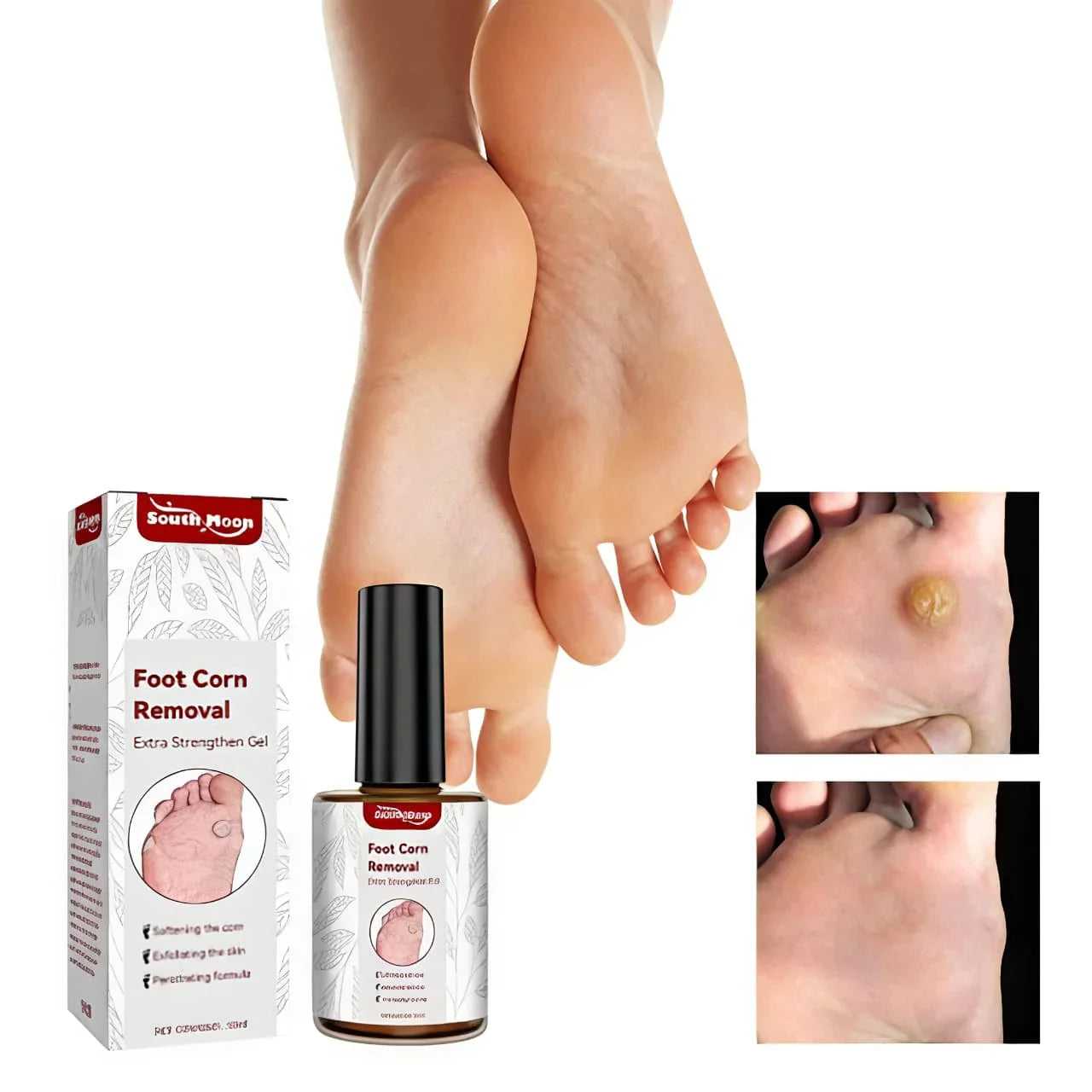 Corn & Callus Removal Serum (30ml) – Smooth Foot Care