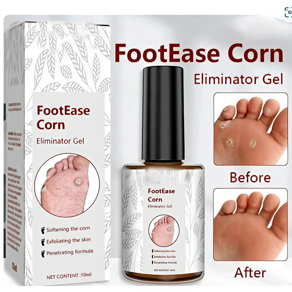 Corn & Callus Removal Serum (30ml) – Smooth Foot Care